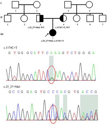 Screening for PRX mutations in a large Chinese Charcot-Marie-Tooth disease cohort and literature review